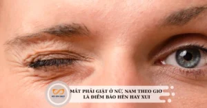 giat-mat-phai-nu-theo-gio-diem-bao-hay-dau-hieu-suc-khoe-can_780