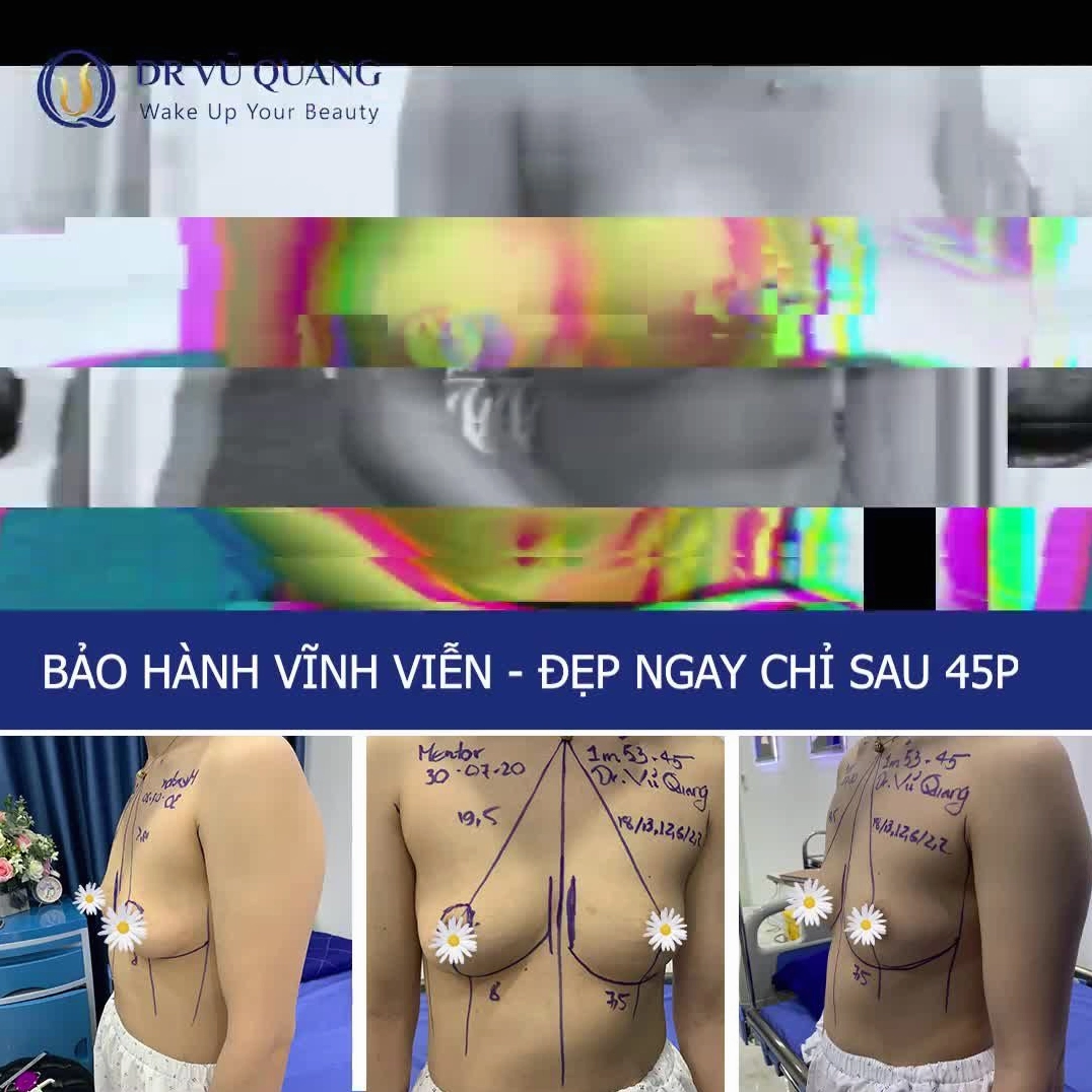 NGƯC ĐẸP NHƯNG GIÁ CÒN ĐẸP HƠN !
