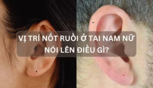 not-ruoi-o-dai-tai-giai-ma-van-menh-tai-loc-va-suc-khoe-chi-_907